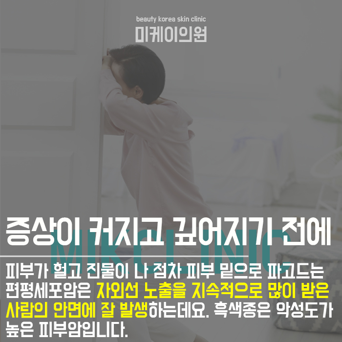 검버섯피부암구분방법 자체적으로 판단하지 마세요 관련 이미지 5