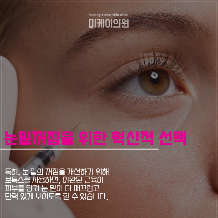눈밑꺼짐시술 종류가 궁금하다면 관련 이미지 3