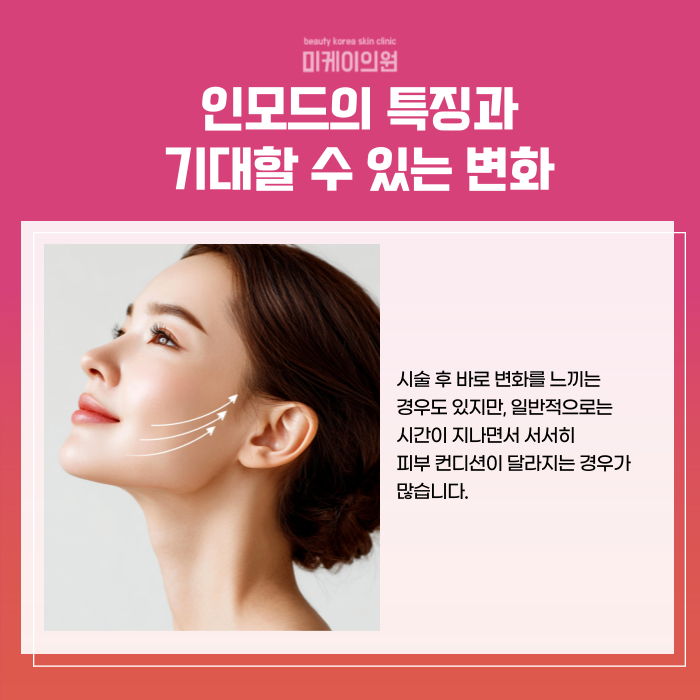 강남 인모드 이벤트 브이라인에 이만한거 없어요 관련 이미지 3
