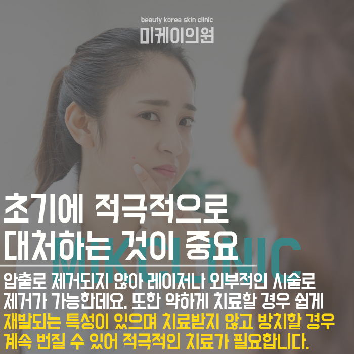 편평사마귀원인 개인에 따라 다를 수 있어 관련 이미지 3