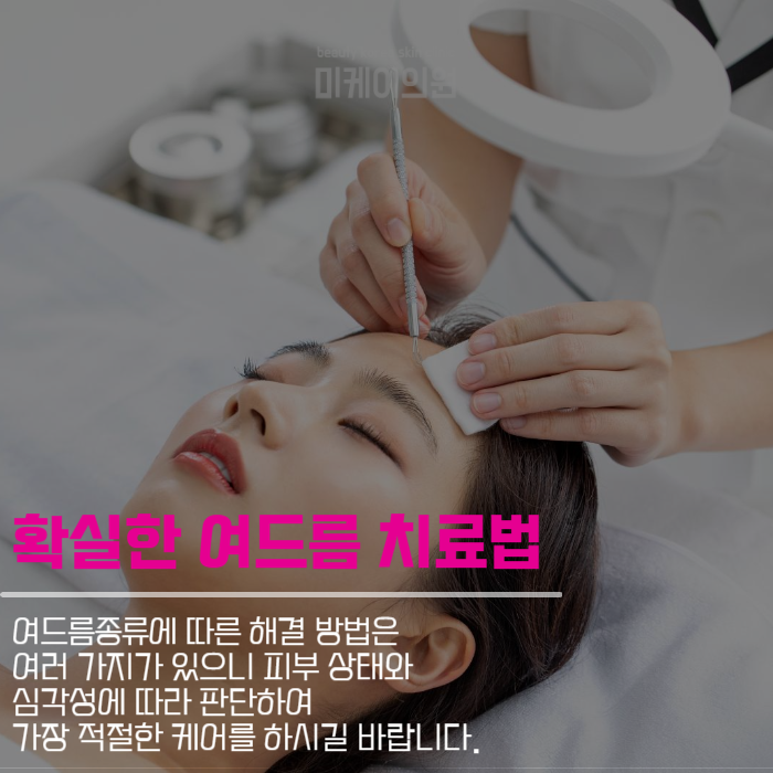 여드름종류 및 관리방법 살펴보기 관련 이미지 5