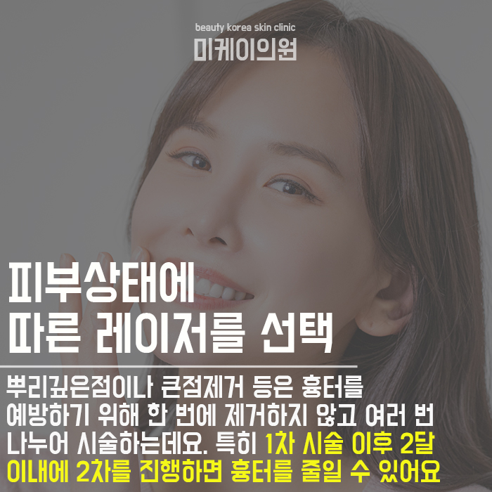 서초동점빼기 개인에 따라 제거방식이 달라 관련 이미지 4