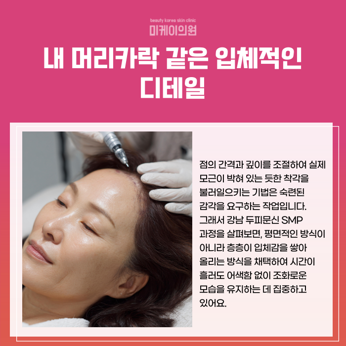 강남 두피문신 SMP 정수리와 이마 고민 관련 이미지 2