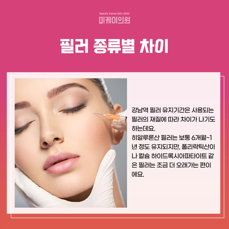 How Long Does the Effect of Filler Last in Gangnam Station? image 3