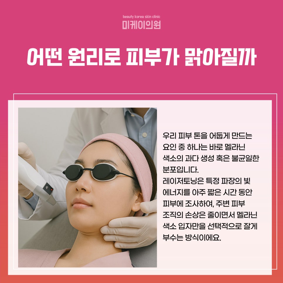 강남 피부과 레이저토닝 깨끗하고 환한 피부의 시작 관련 이미지 2