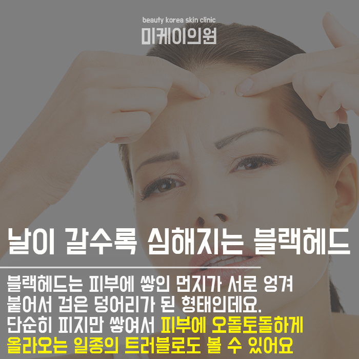 강남블랙헤드제거 섬세하게 관련 이미지 3