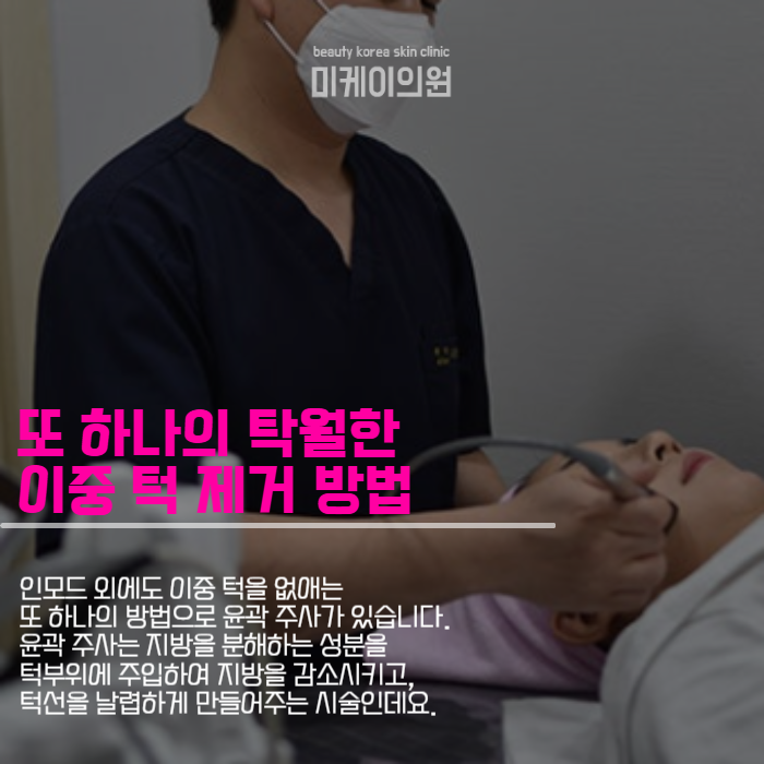 투턱없애기 인모드와 윤곽 주사로 관련 이미지 4
