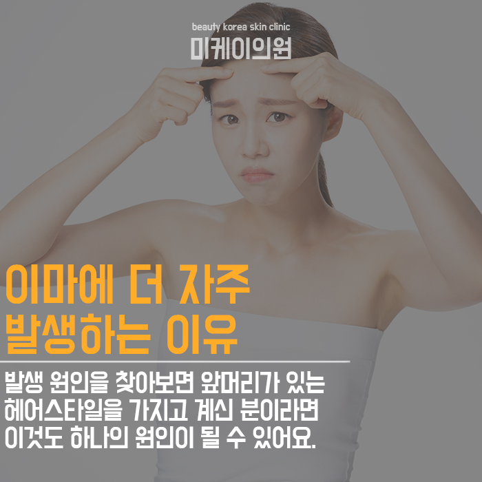 좁쌀뾰루지예방 평소 습관과 관리가 중요해요 관련 이미지 3
