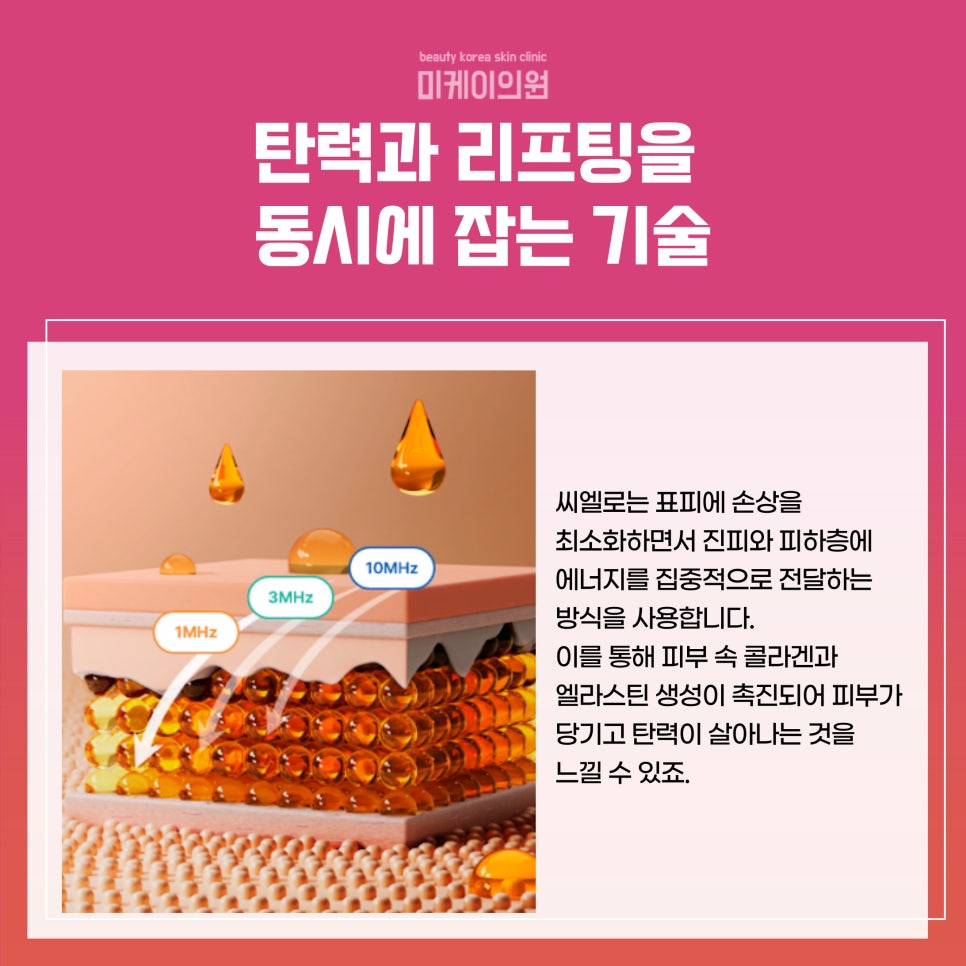 강남 피부과의원 씨엘로 시술의 모든 것 관련 이미지 2