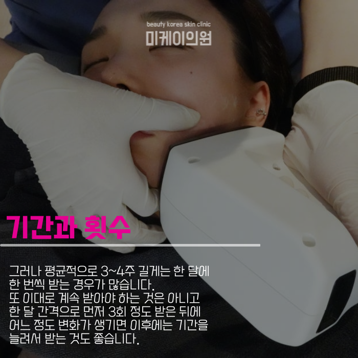 인모드fx 시술주기 맞춰야 하니까 관련 이미지 4
