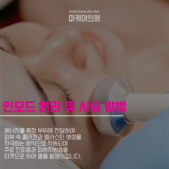 강남 인모드 저렴한곳에서 효과적인 관리 관련 이미지 4