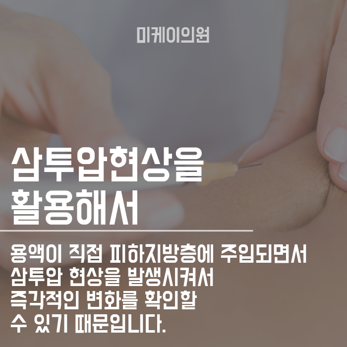 강남 바디라인주사HPL 뱃살에 맞고 운동하면 효과 관련 이미지 3