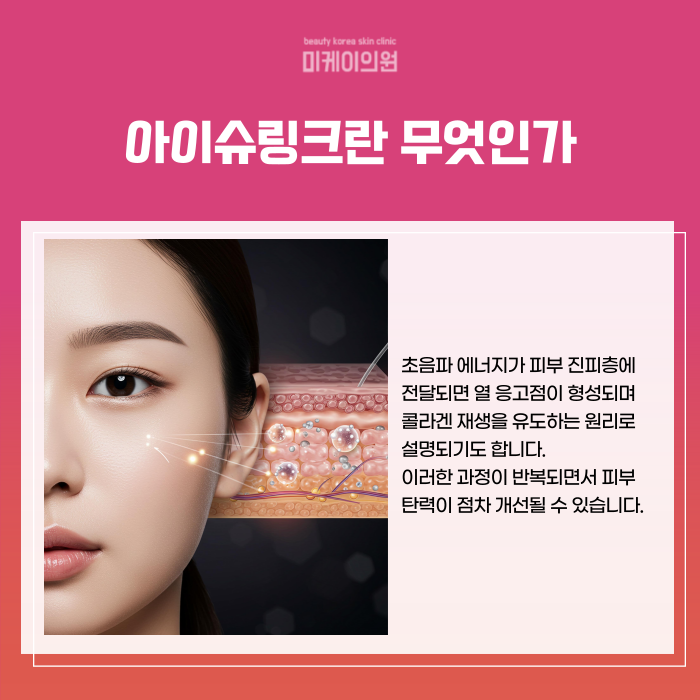 강남 눈가주름관리 아이슈링크와 주름보톡스로 해결 관련 이미지 3