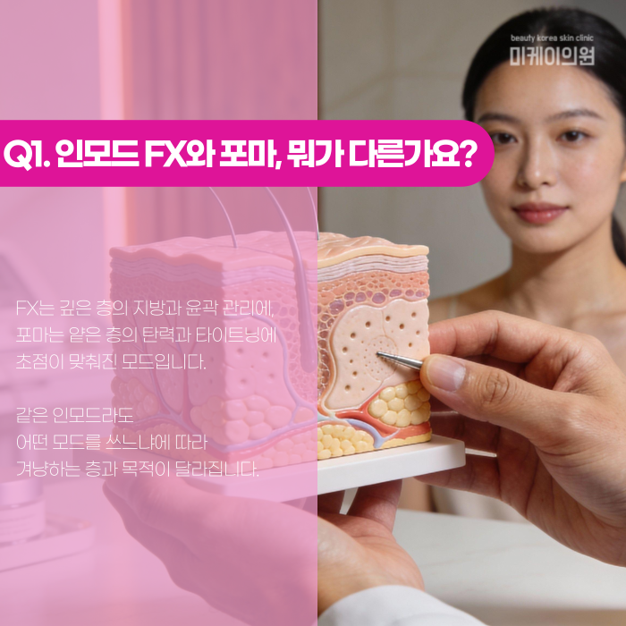 강남 인모드, FX와 포마는 뭐가 다를까? 관련 이미지 2