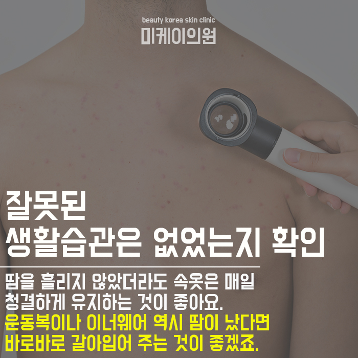 갑자기 생긴 가슴여드름 해결하는방법 따라해보세요 관련 이미지 3