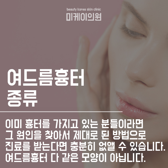 강남성인여드름 고민하지말고 관련 이미지 4