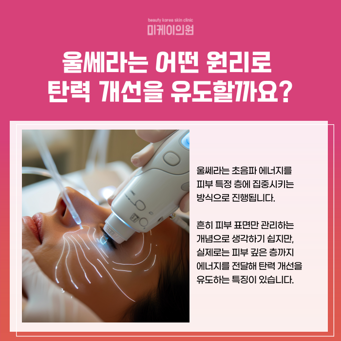 Tips You Should Know Before a Gangnam Station Ulthera Event Procedure image 2