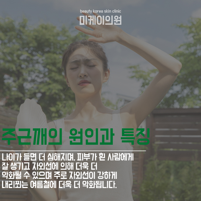 주근깨원인과 제거방법 관련 이미지 3