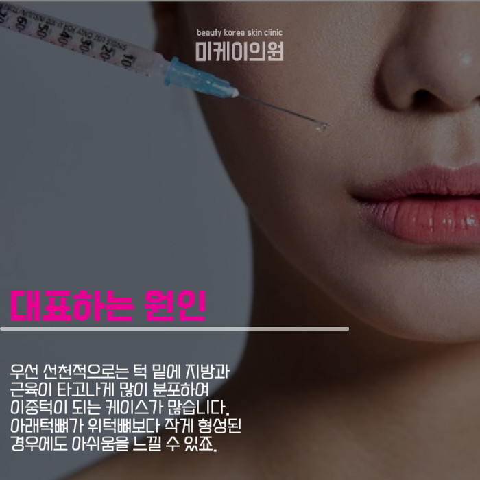 강남역 이중턱주사 라인이 무너졌을 땐 관련 이미지 2