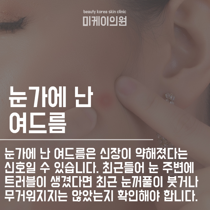 여드름 위치별 건강 상태 체크할 수 있어요! 관련 이미지 3