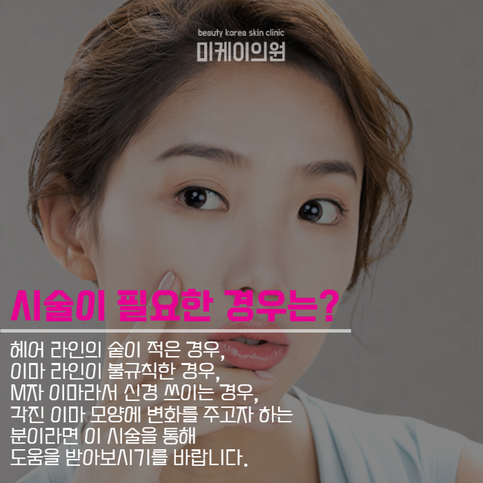 강남헤어라인 비어 보이거나 M자로 변했다면 관련 이미지 3