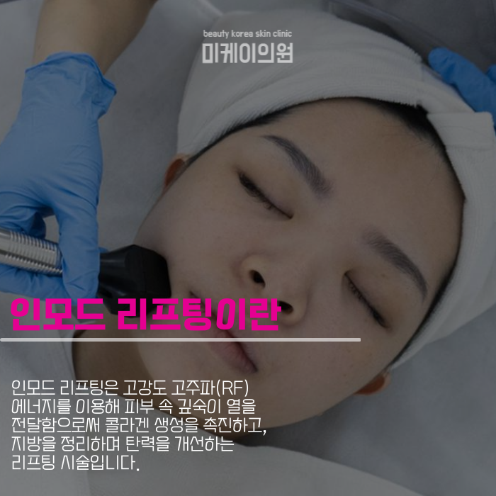 Gangnam InMode Lifting: A Customized Solution for Improved Facial Contours image 3