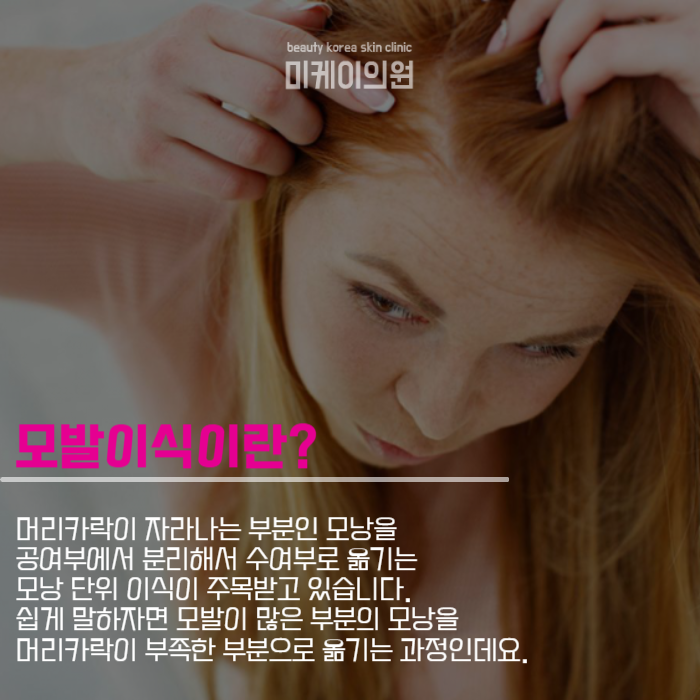 탈모커버하는방법 모발이식부터 반영구까지 관련 이미지 2