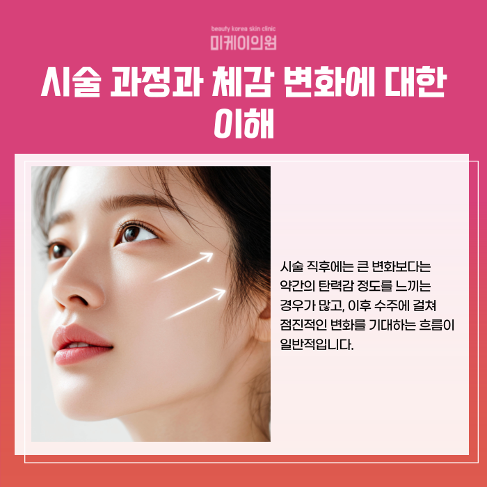 Principles of Ultherapy Lifting at Seocho Station and Selection Criteria image 5