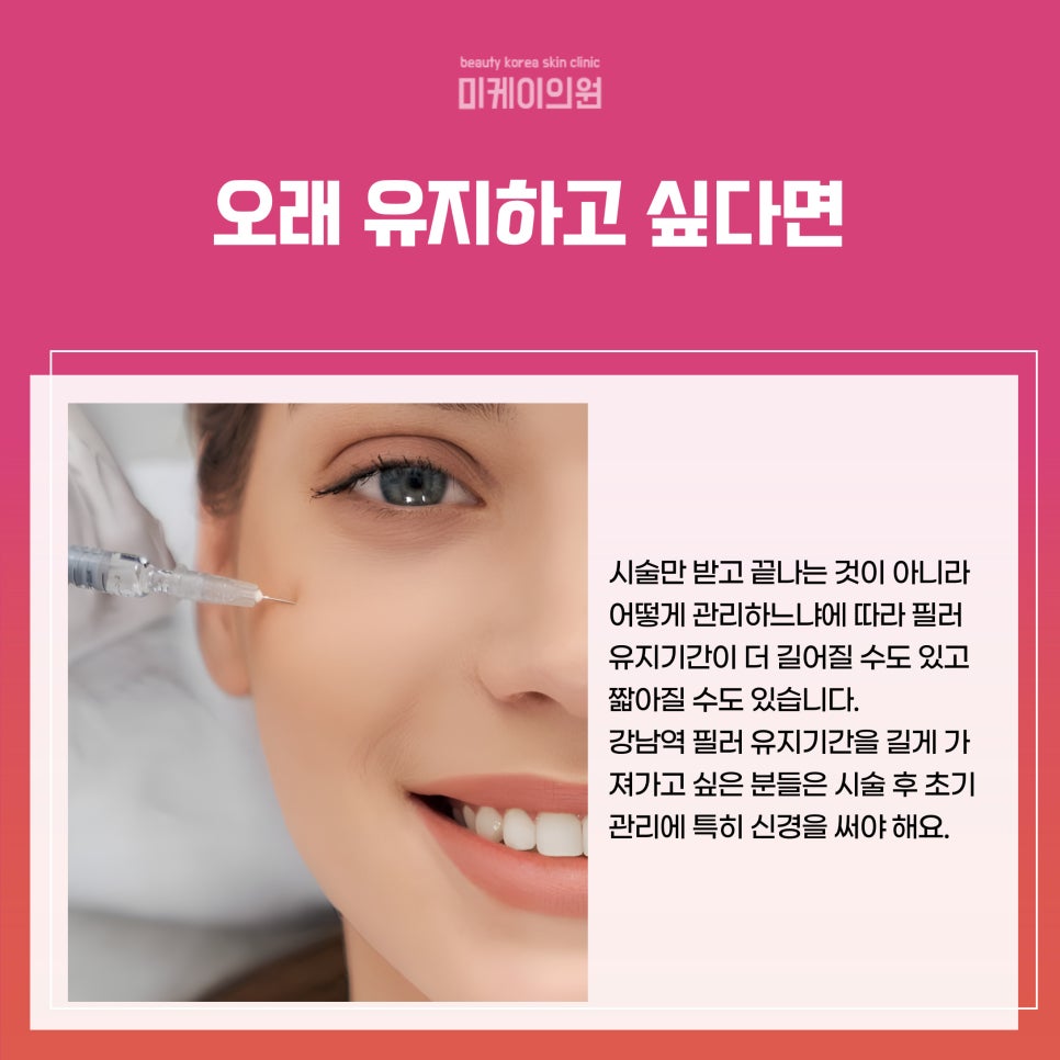 How Long Does the Effect of Filler Last in Gangnam Station? image 2