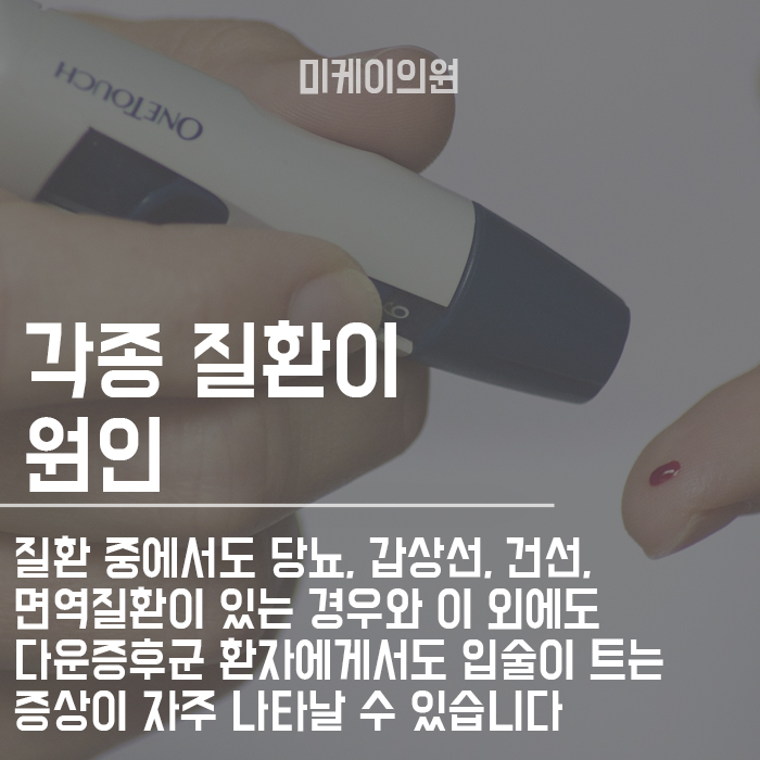 입술각질제거 집에서 손쉽게 촉촉한 입술로 관련 이미지 4