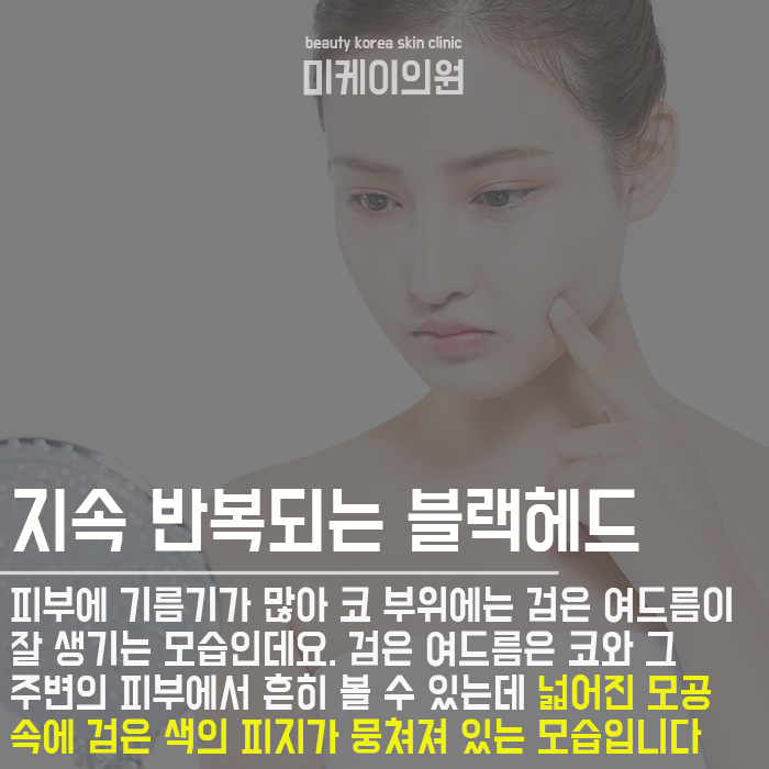 T존케어 복잡하지 않아요 관련 이미지 4