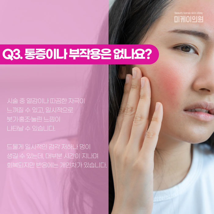 Gangnam Ultherapy Lifting: When Do the Effects Start to Show? image 4