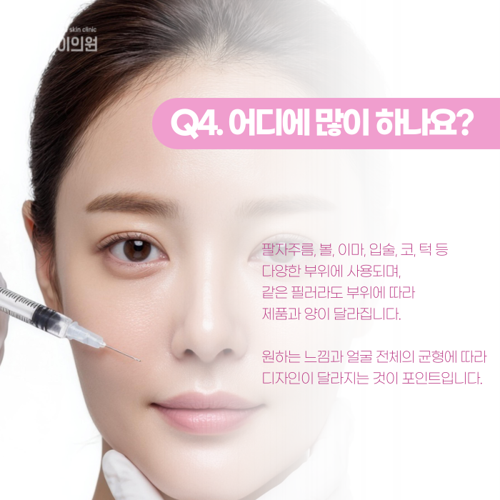 Dermal Fillers Near Gangnam Station: Where and How Should They Be Injected? image 5