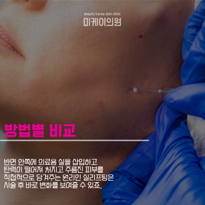 강남역실리프팅 다시 찾는 리즈시절 관련 이미지 2
