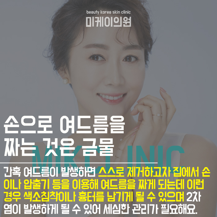 여드름관리하는방법 개인마다 다를 수 있어 관련 이미지 2