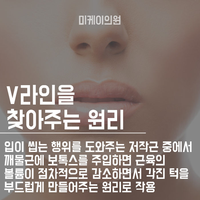 사각턱보톡스 완벽한 V라인이 되기 위한 방법 관련 이미지 2