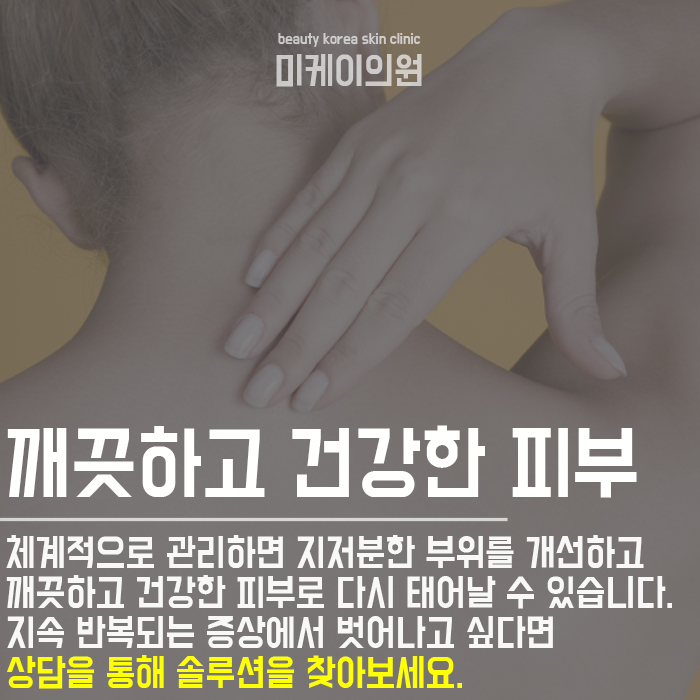 등드름자국제거방법 쉽고 간편하게 관련 이미지 6