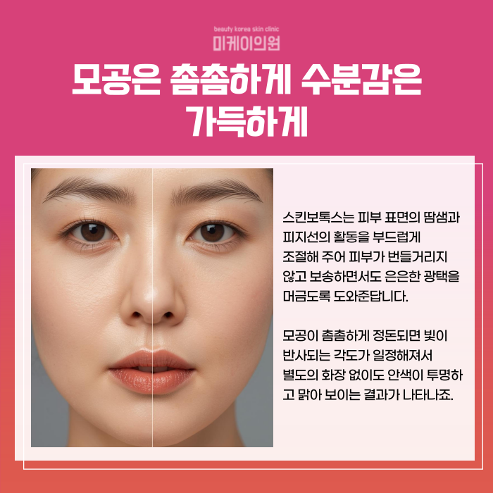강남역 스킨보톡스 섬세한 터치 관련 이미지 3