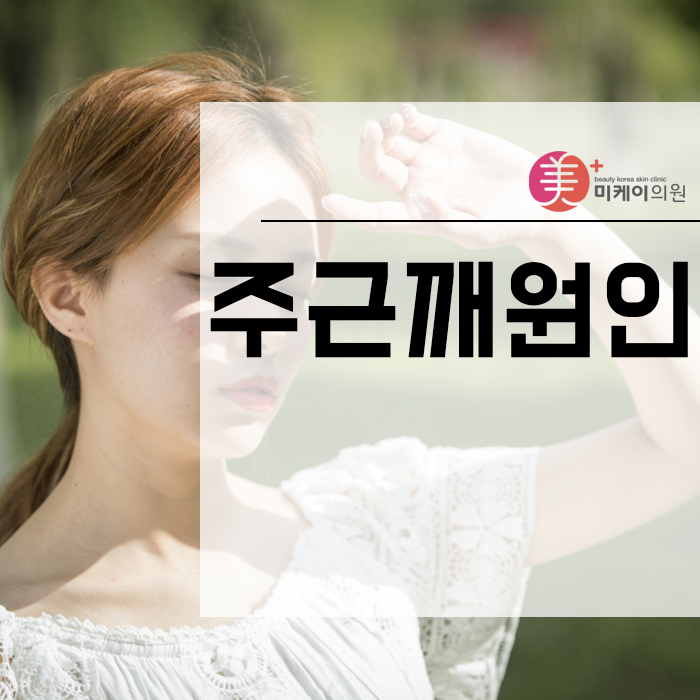 주근깨원인과 제거방법 관련 이미지 1