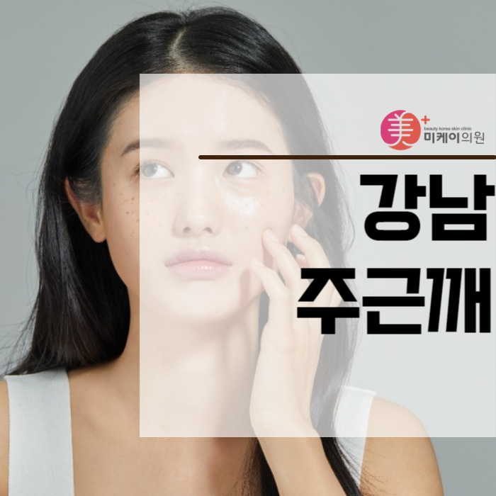 강남주근깨 얼룩덜룩해진 이유는 관련 이미지 1