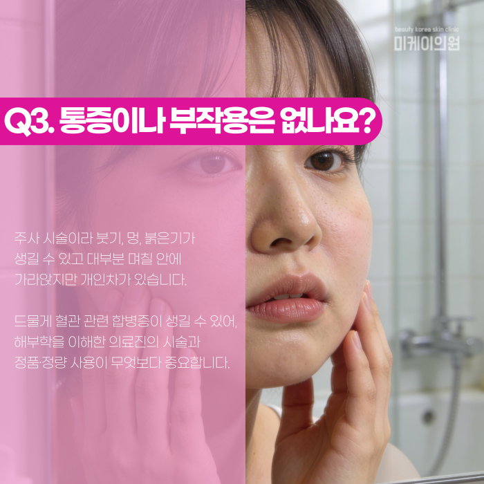 Dermal Fillers Near Gangnam Station: Where and How Should They Be Injected? image 4