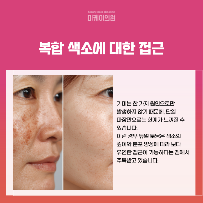 서초역 레이저토닝 깔끔한 기미제거 시술 관련 이미지 4