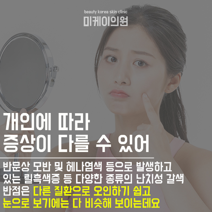 난치성갈색반점 어렵고 재발이 잦은 질환 관련 이미지 4