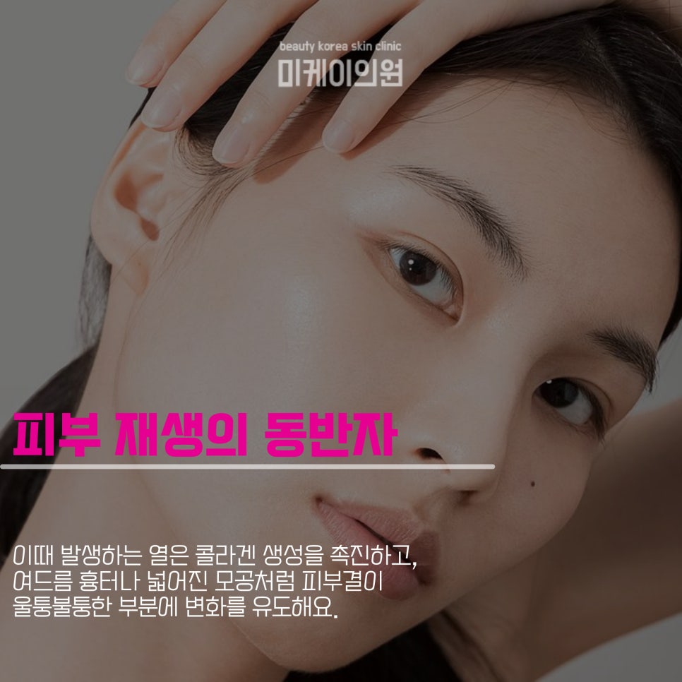 Potenza and LDM at a Gangnam Station Acne Dermatology Clinic image 2