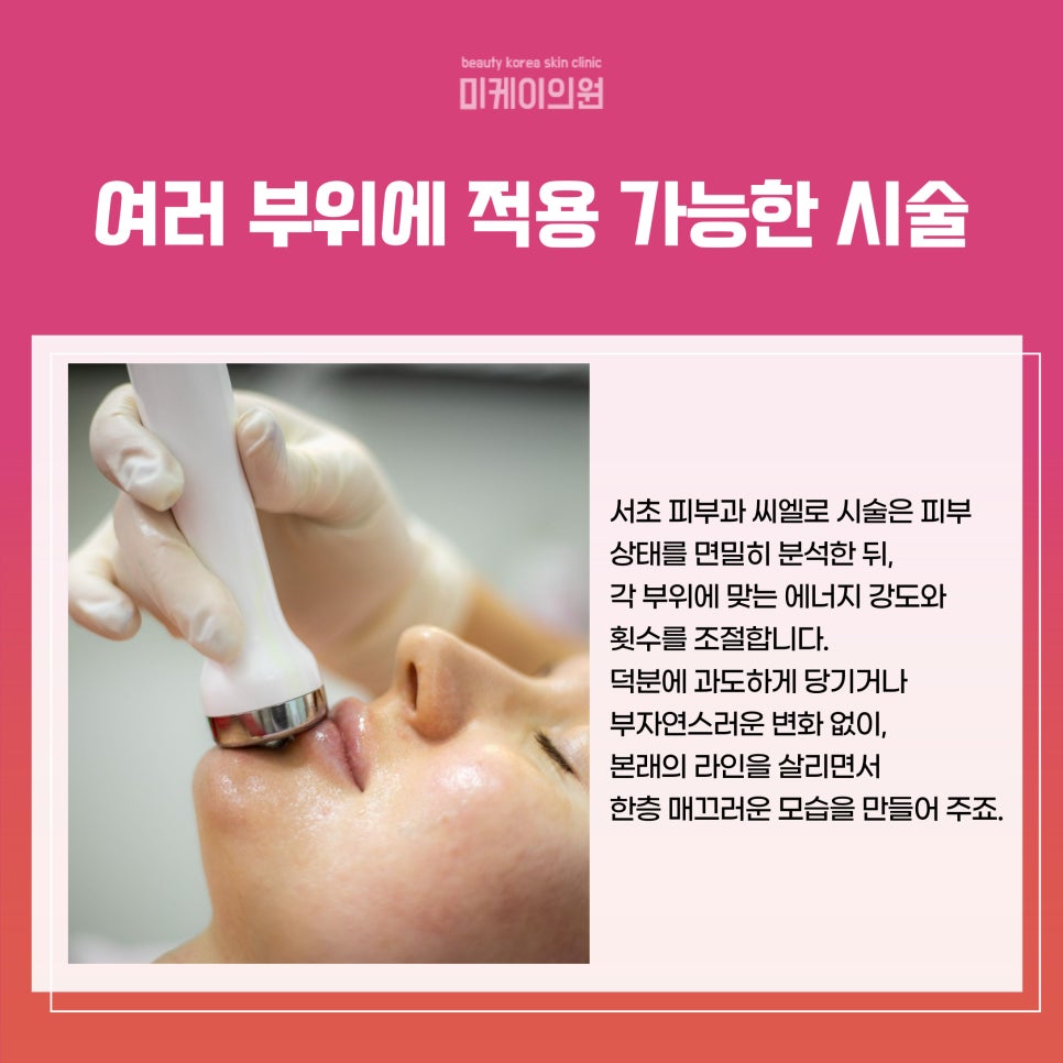 서초 피부과 씨엘로 시술 가이드 관련 이미지 3