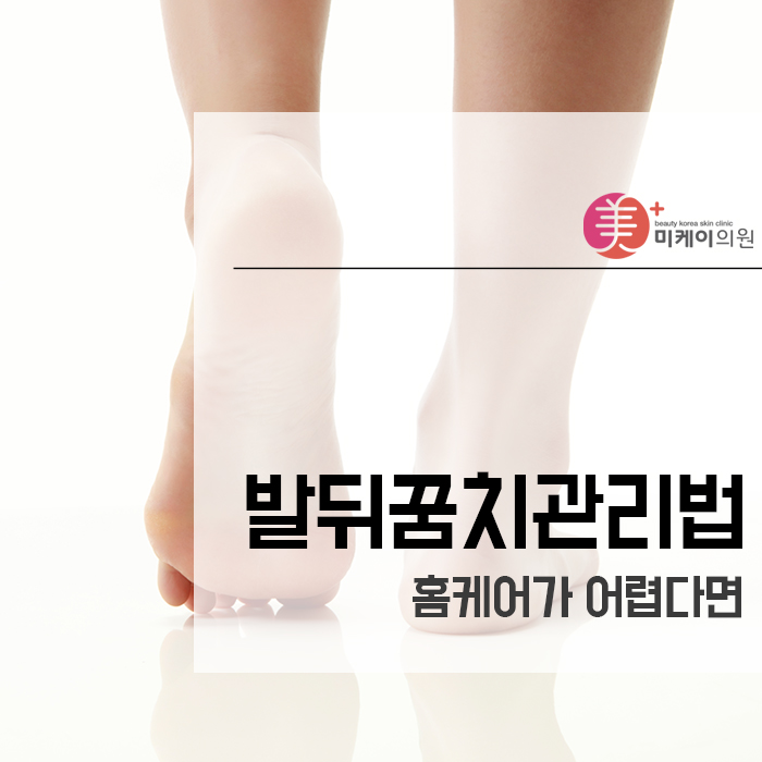 발뒤꿈치관리법 홈케어가 어렵다면 관련 이미지 1