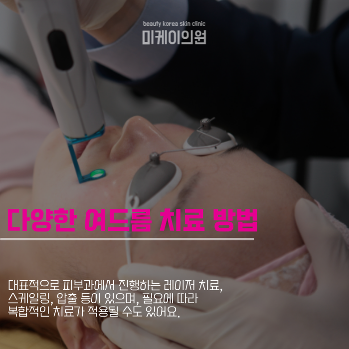 강남역주말피부과에서 피부 타입별 여드름 치료 관련 이미지 3