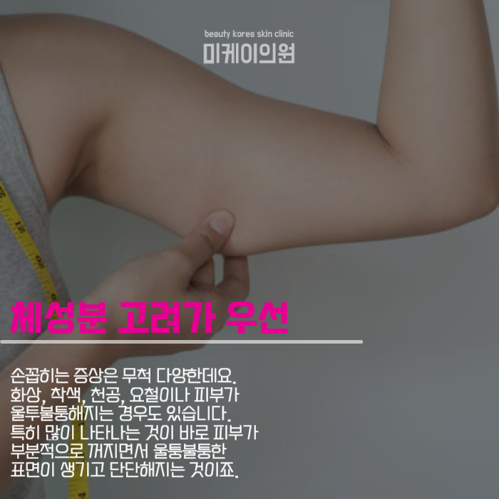 팔뚝 지방흡입 부작용 걱정될 때는 관련 이미지 2