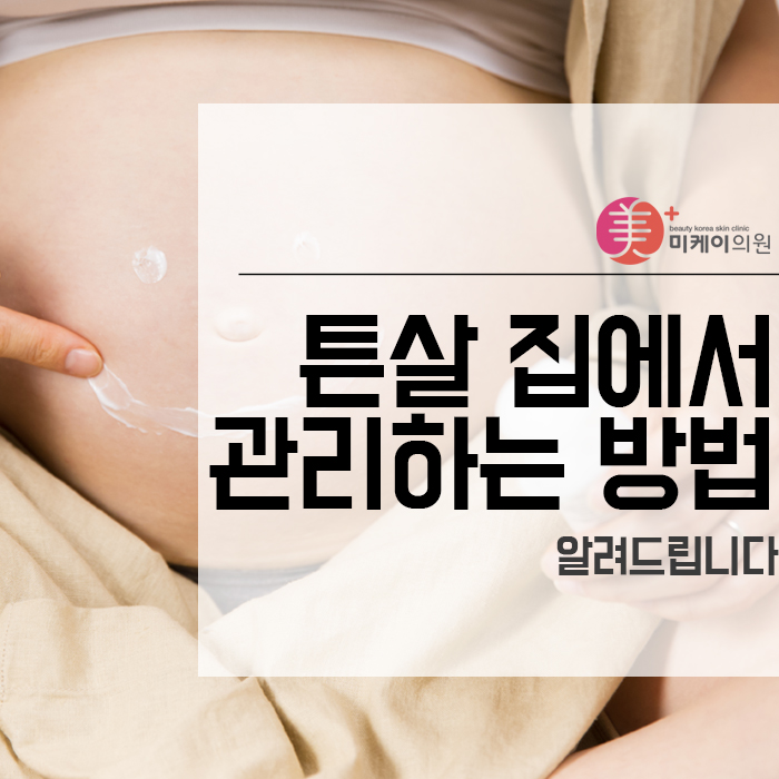 튼살 집에서 관리하는 방법 알려드립니다 관련 이미지 1
