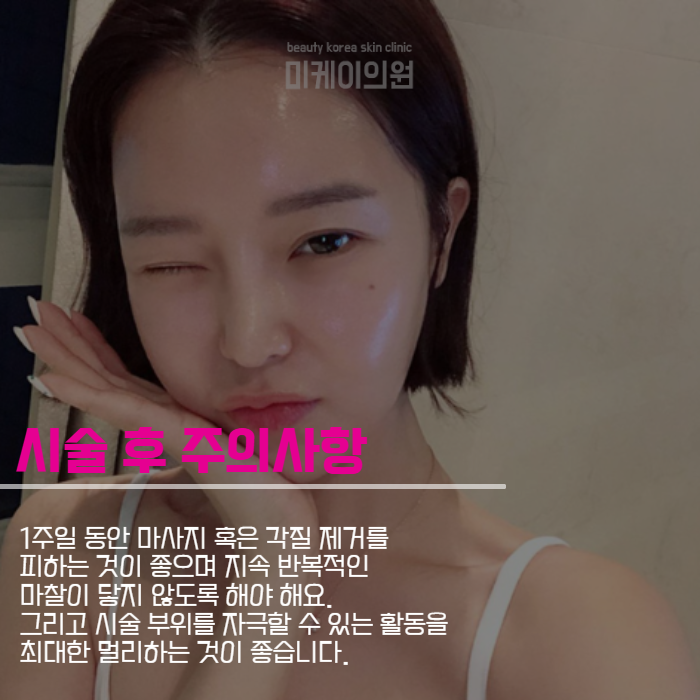 쥬베룩볼륨효과 나에게 맞는 시술 찾기 관련 이미지 5